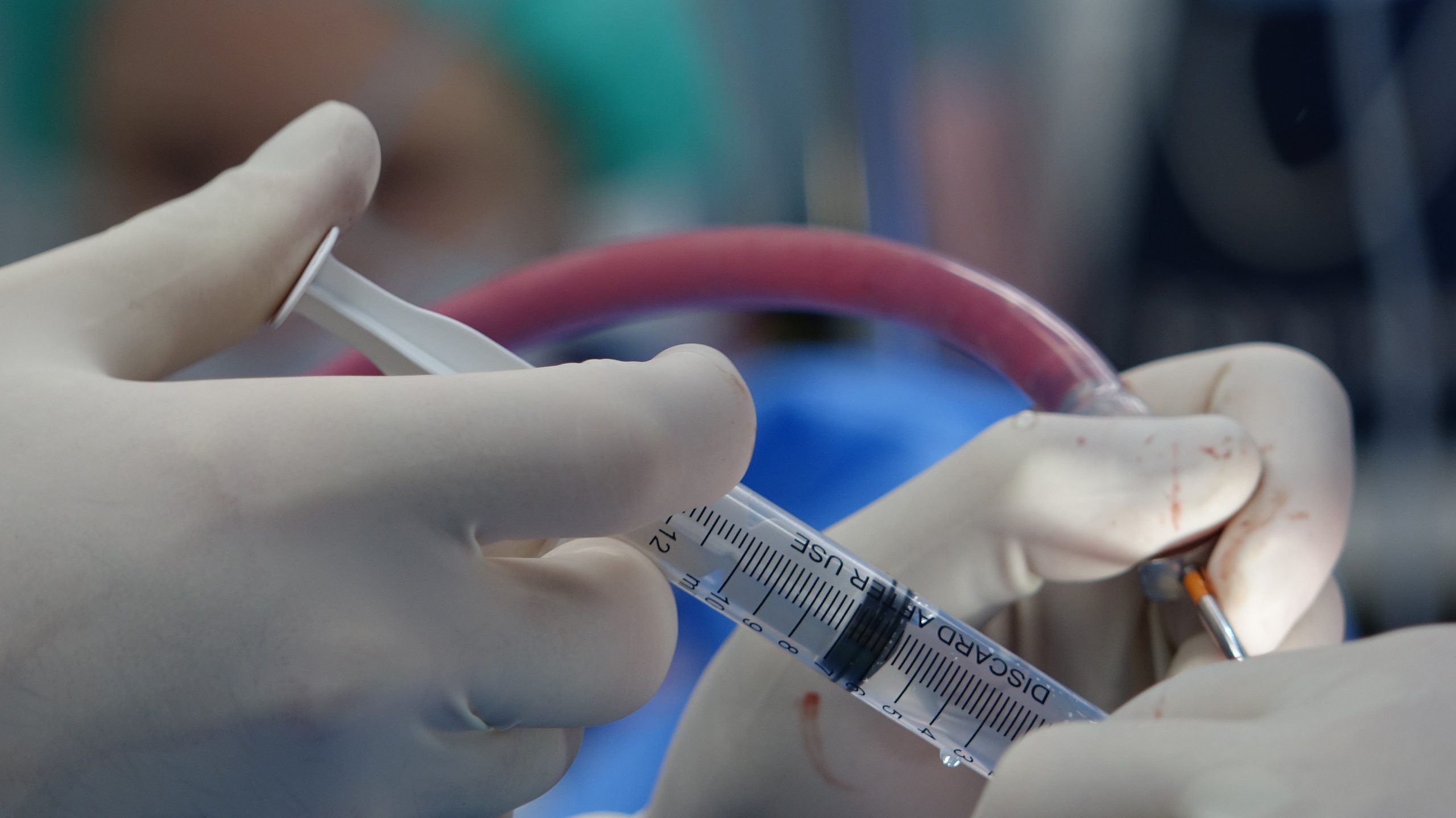 Influence du calibre de l'aiguille sur les complications