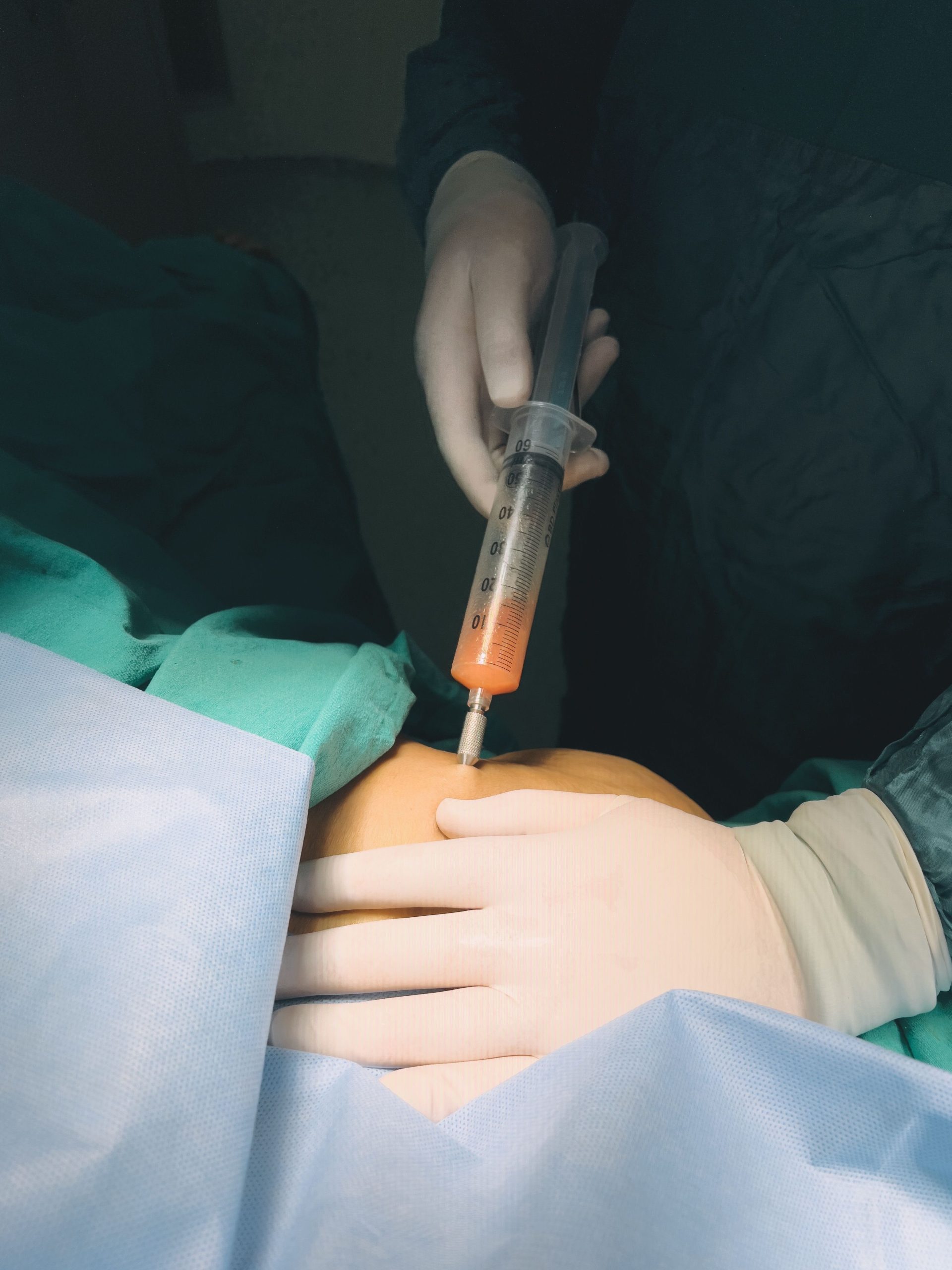 Quelle est la différence entre rachianesthésie et péridurale ?