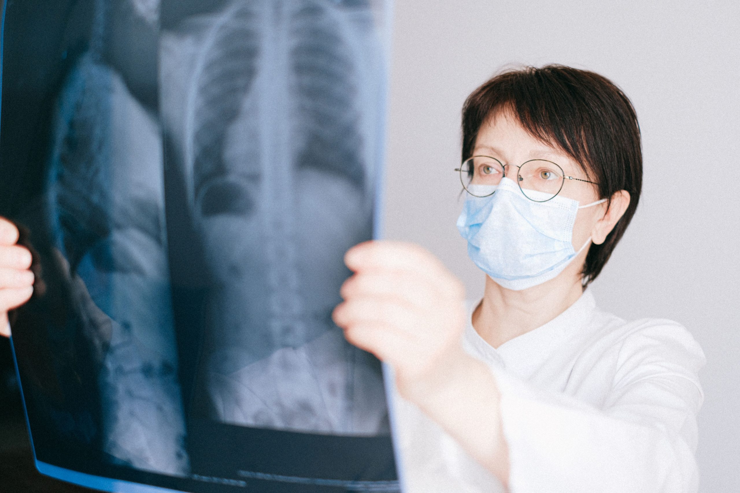 Médecin examine une radiographie thoracique en clinique