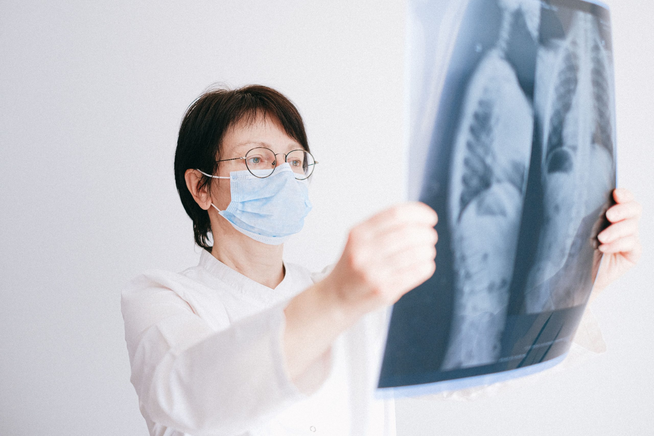 Médecin masqué analyse une radio pulmonaire