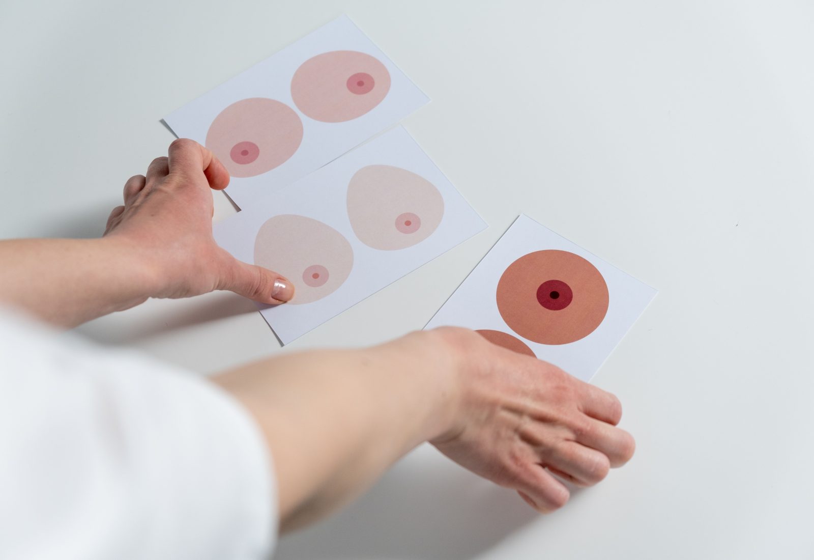 Un ganglion intra mammaire, c&rsquo;est vraiment grave ?