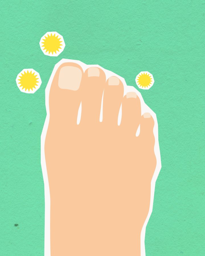 Illustration microbes causant mycose podiale