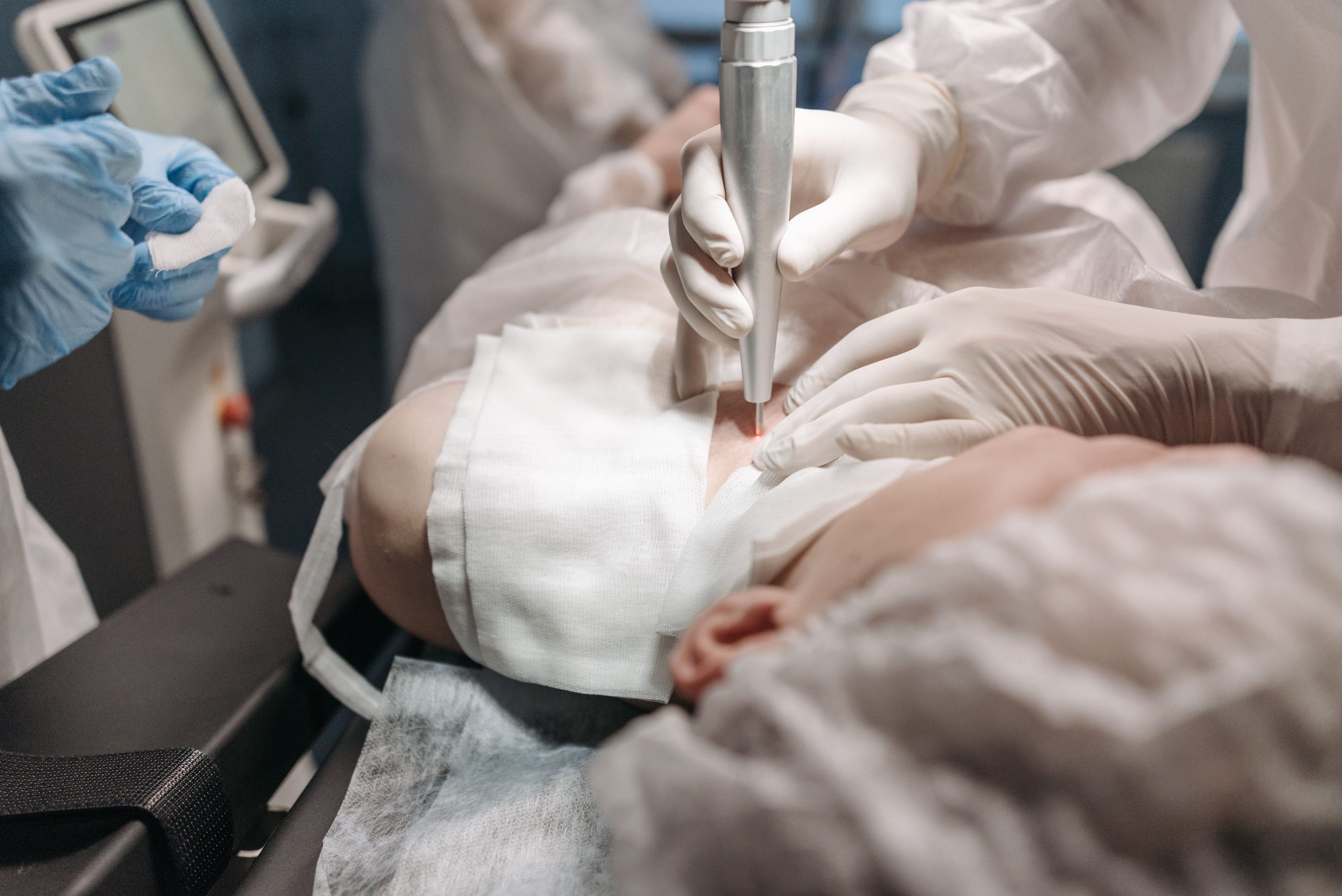 Professionnels medicaux effectuant traitement laser peau