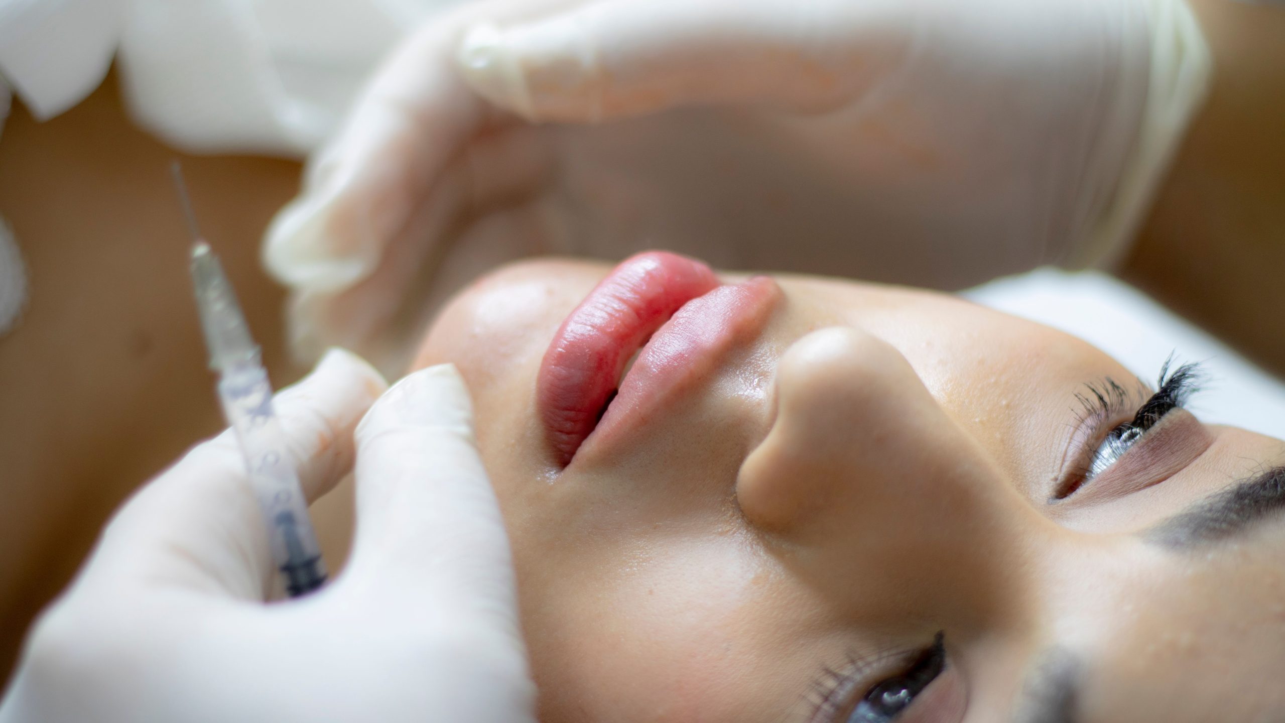 Augmentation des lèvres avec seringue par un professionnel